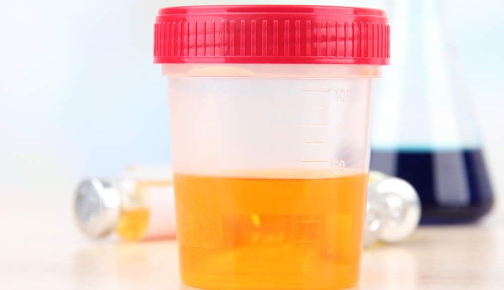 What Is Your Urine Colour? If everything is normal and healthy,the color