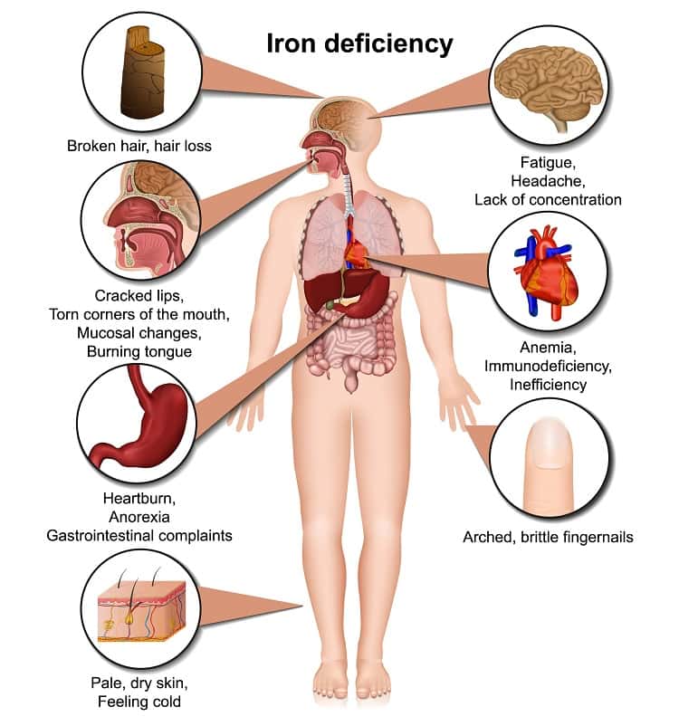 deficiency-of-iron-causes-biology